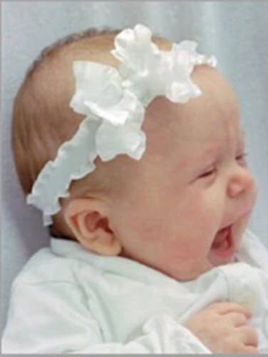 Millie Frilly Bowband